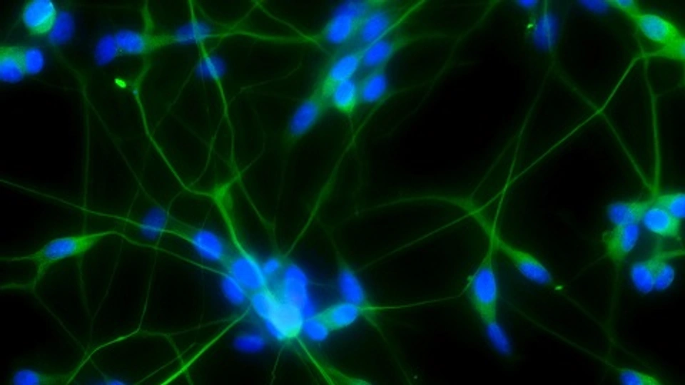An image showing living neuronal cell circuits grown in the lab