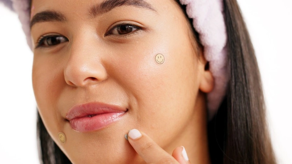 A young woman using patches to cover her pimples